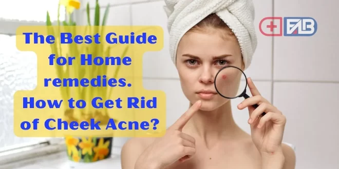 how to get rid of cheek acne